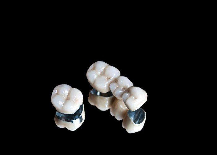 Ceramic dental crowns